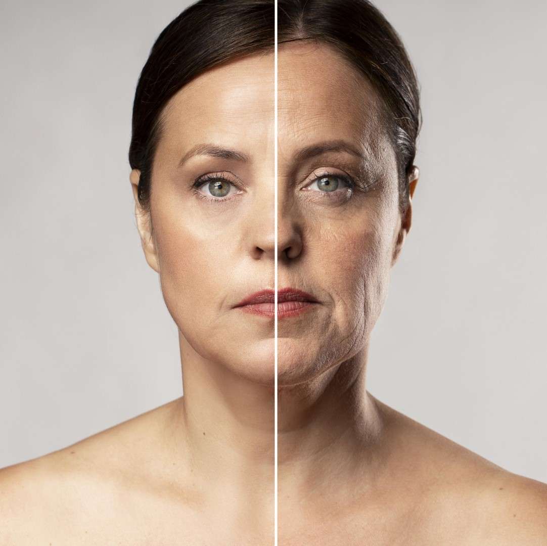 Rejuvenecimiento facial en Granada