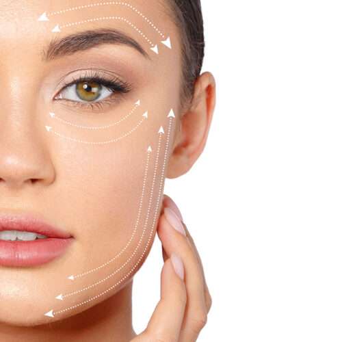 Microlifting facial en Granada