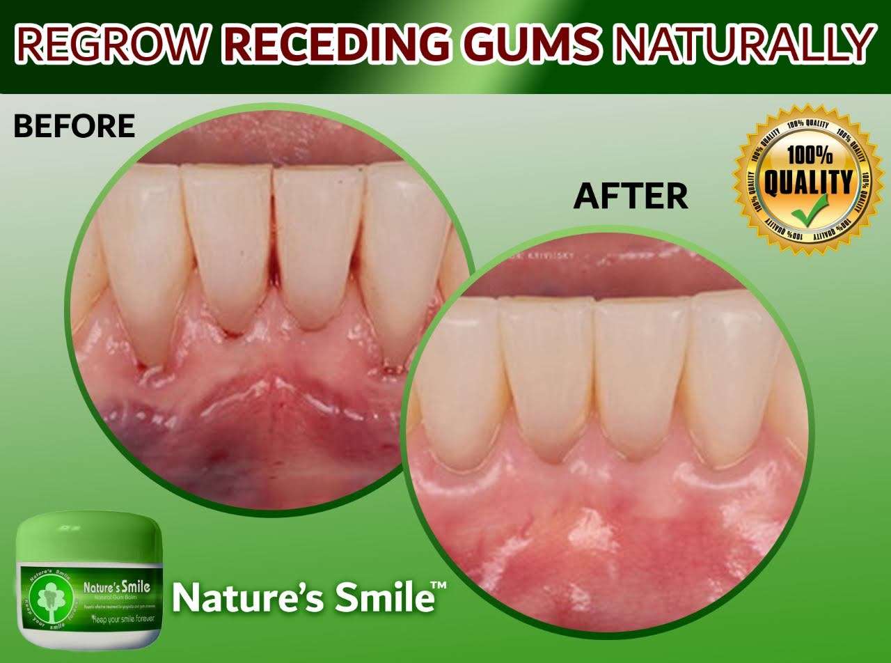 How Nature’s Smile™ Can Help You Regrow Your Gums Naturally