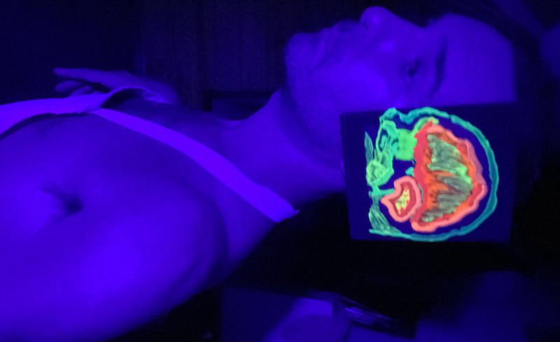 post pulsion de muerte