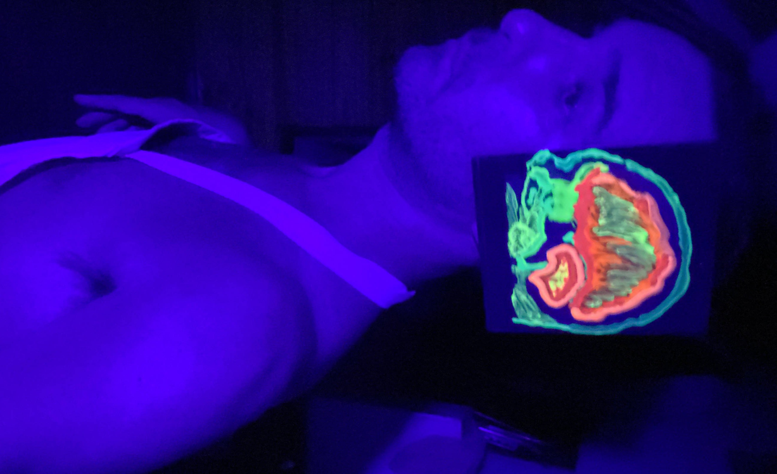 post pulsion de muerte