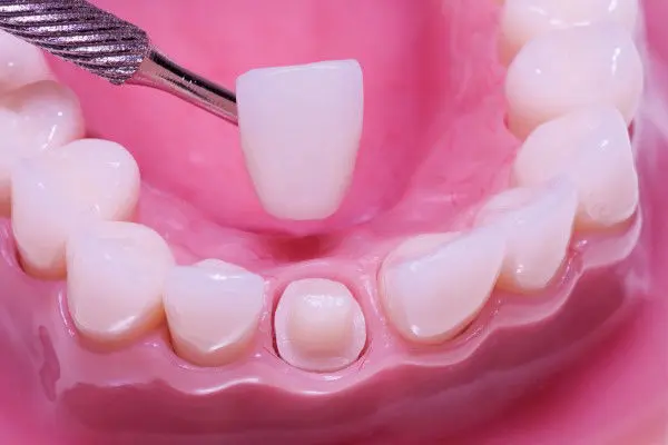 Austin Dentist